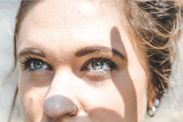 Bulbous Nose Rhinoplasty